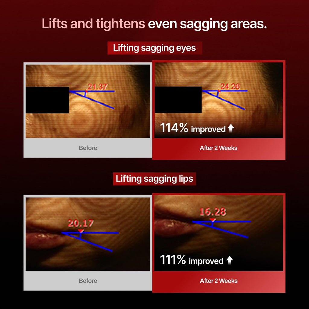 Meditherapy - Wrinkle fit mask